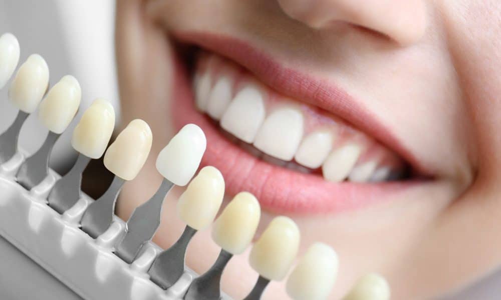 The Importance of a Cosmetic Dentist: Transforming Smiles with Dental Implants and Restoration